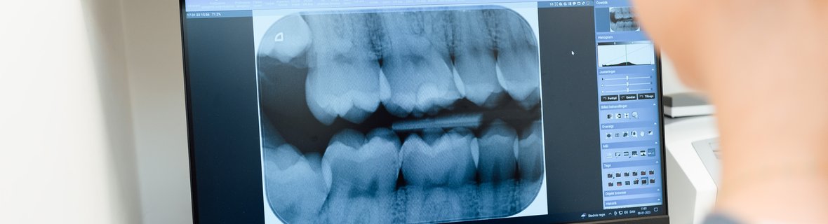 Tandlæge østbirk behandlinger